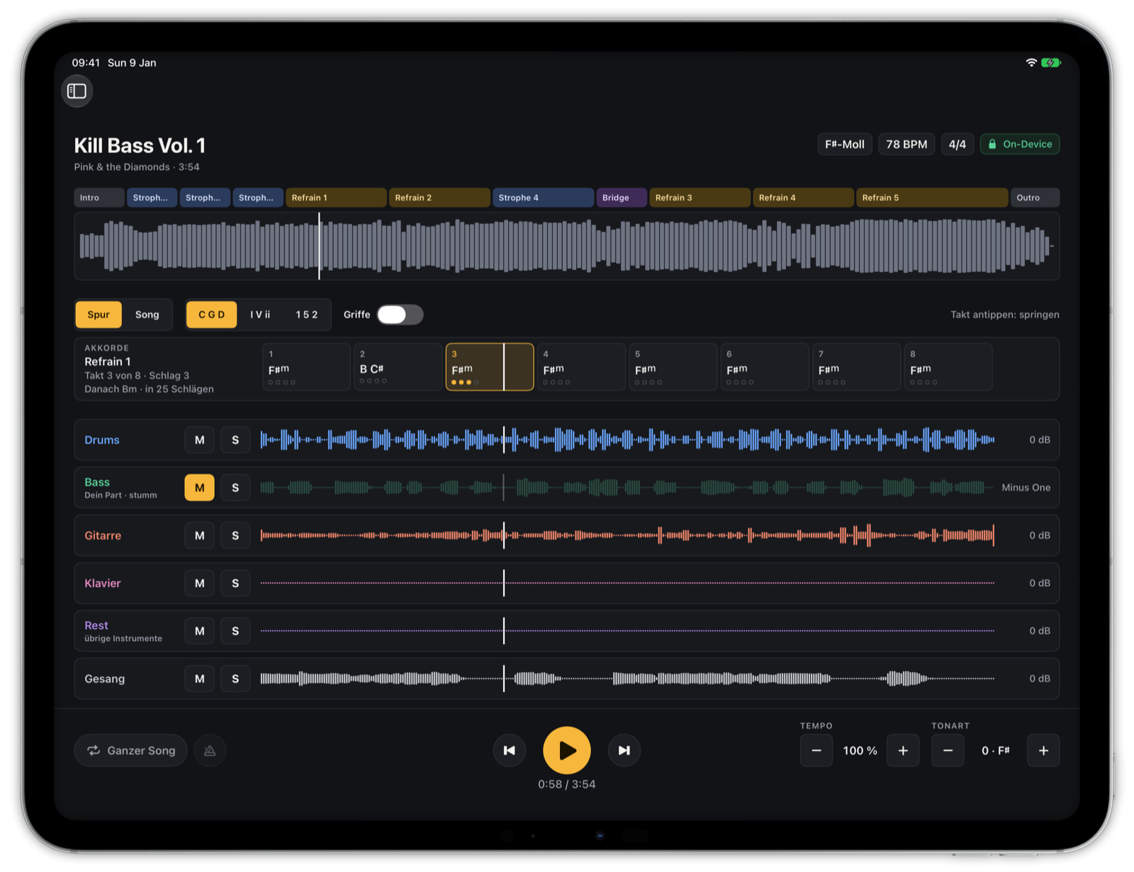 The Shed auf dem iPad: ein Song in sechs Stems, der Bass als dein Part stumm geschaltet